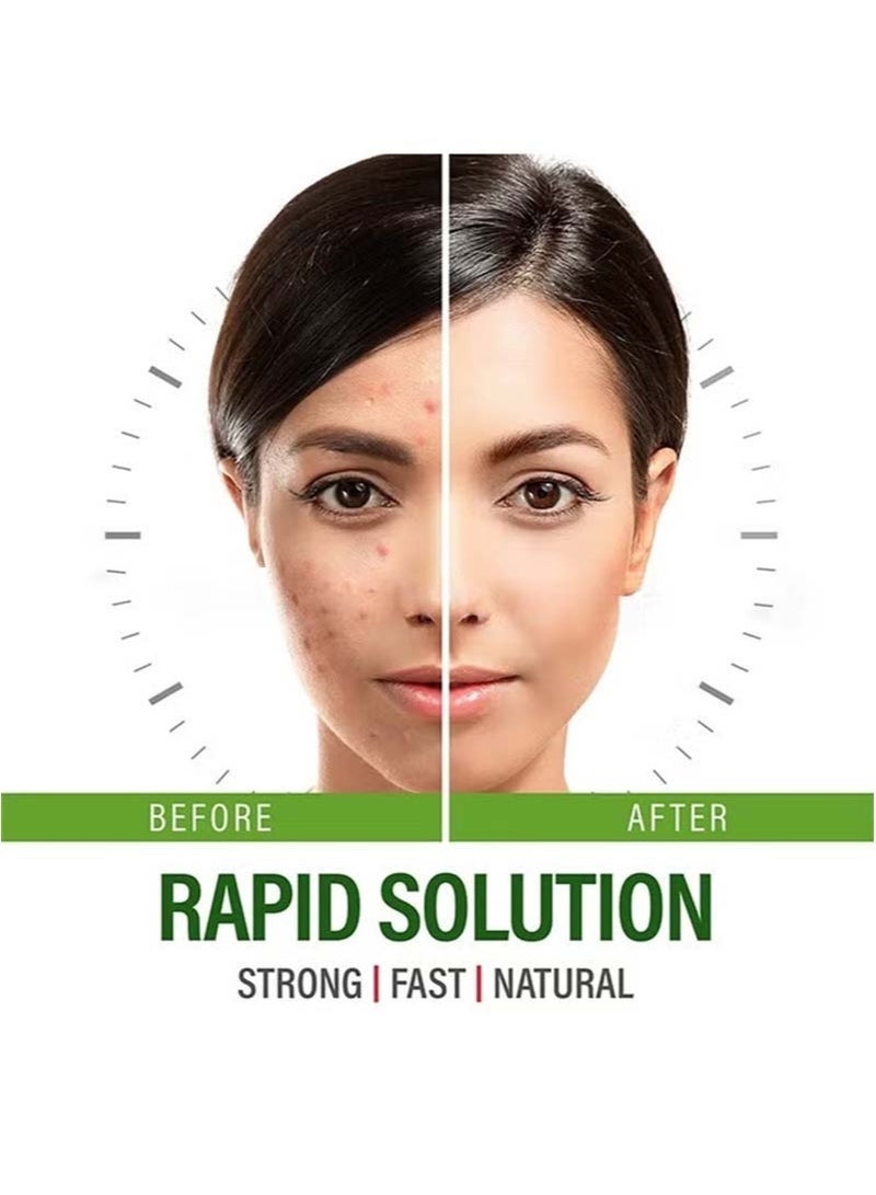 LINE ONE Acne Pills For Teens and Adults Perfect Skin Capsules For Cystic Acne Hormonal Acne Treatment With Vitamin Complex and Zinc Acne Pills For Oily Skin Control Vegan Nongmo  - Image 2