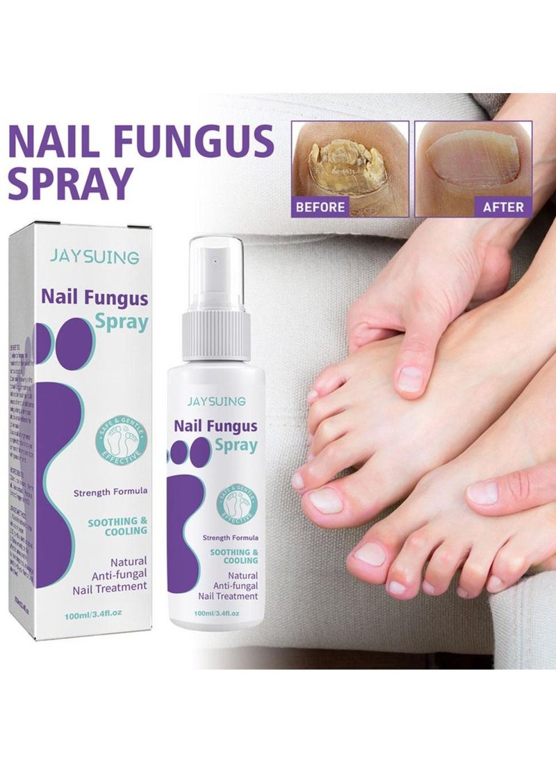 Jaysuing - Fungus Spray, Nail Fungus Treatment For Toenail And Nail Strengthener - Image 1
