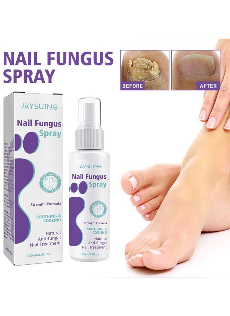 Jaysuing - Fungus Spray, Nail Fungus Treatment For Toenail And Nail Strengthener - Image 1