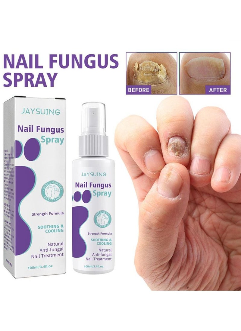 Jaysuing - Fungus Spray, Nail Fungus Treatment For Toenail And Nail Strengthener - Image 1
