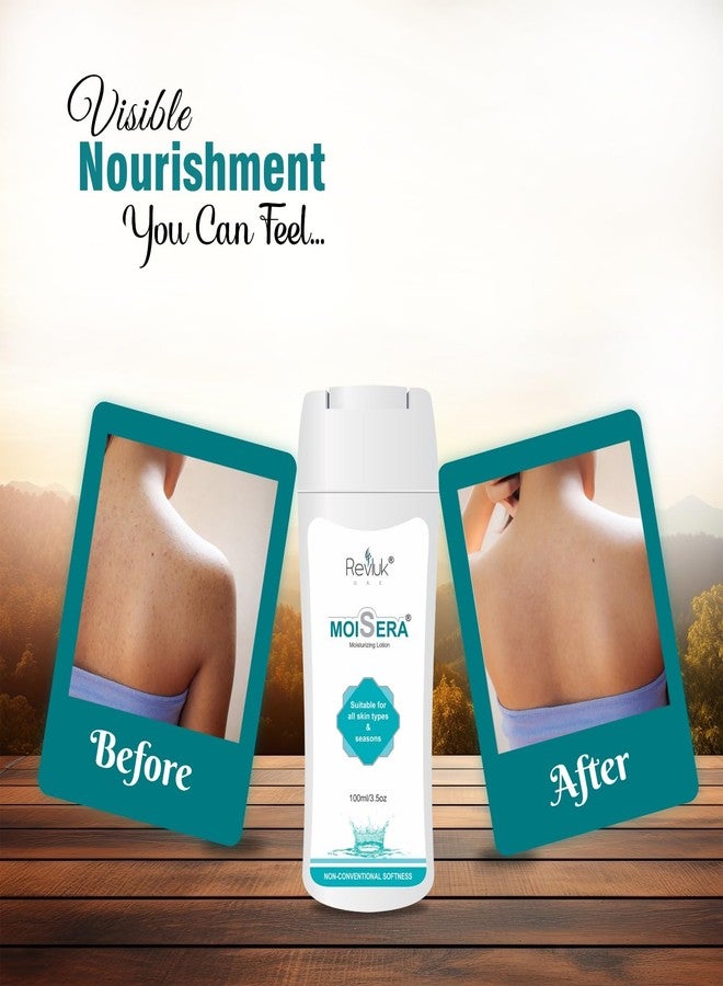 Revluk Moisera Moisturizing Lotion for Dry & Sensitive Skin | Long-Lasting Hydration | Non-Greasy Daily Use Body Lotion| Duo Pack - Image 2