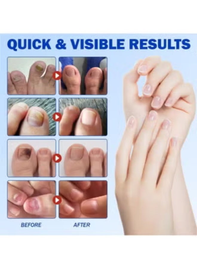 BOSART Fungal Nail Repair Patches – Effective Care Solution for Healthy, Strong Toenails. Easy-to-Use, Fast-Acting & Long-Lasting Results - Image 3
