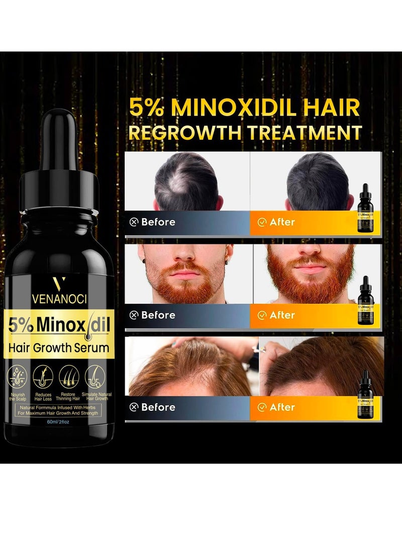 Venanoci - 5% Minoxidil for Men Hair Growth Oil: Hair Regrowth Treatment for Scalp Hair Loss & Beard - Hair Growth Serum for Thicker, Longer, Fuller, Healthier Hair - Image 1
