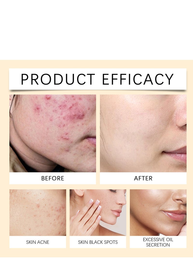 Hoygi - Hoygi Rice Honey Moisturizing Brightening Mask Moisturizing Hydrating Nourishing Improve Facial Skin Gloss 150ml - Image 1