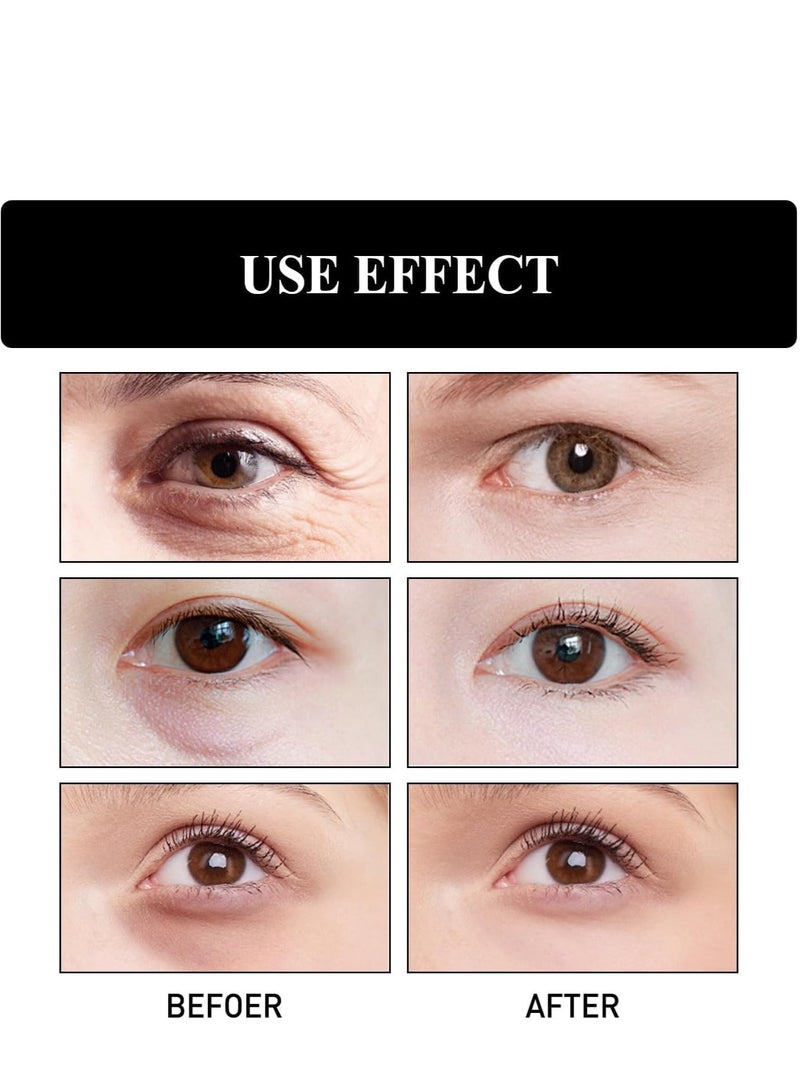 Lanthome 2PCS Castor Oil Rollerball, Frankincense & Castor Oil Eye Roller, Anti-Wrinkle & Anti-Aging Under Eye Cream, Hydrating & Nourishing Eye Cream for Wrinkles and Dark Circles - Image 2