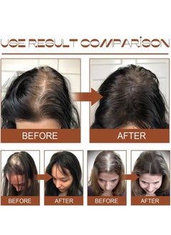 EELHOE Batana Oil for Hair Growth Healthier Thicker Fuller Hair, Batana oil, Batana Oil for Hair Growth, Batana Oil Organic, Batana Oil Organic for Healthy Hair, Batana Oil Hair Mask  - Image 3