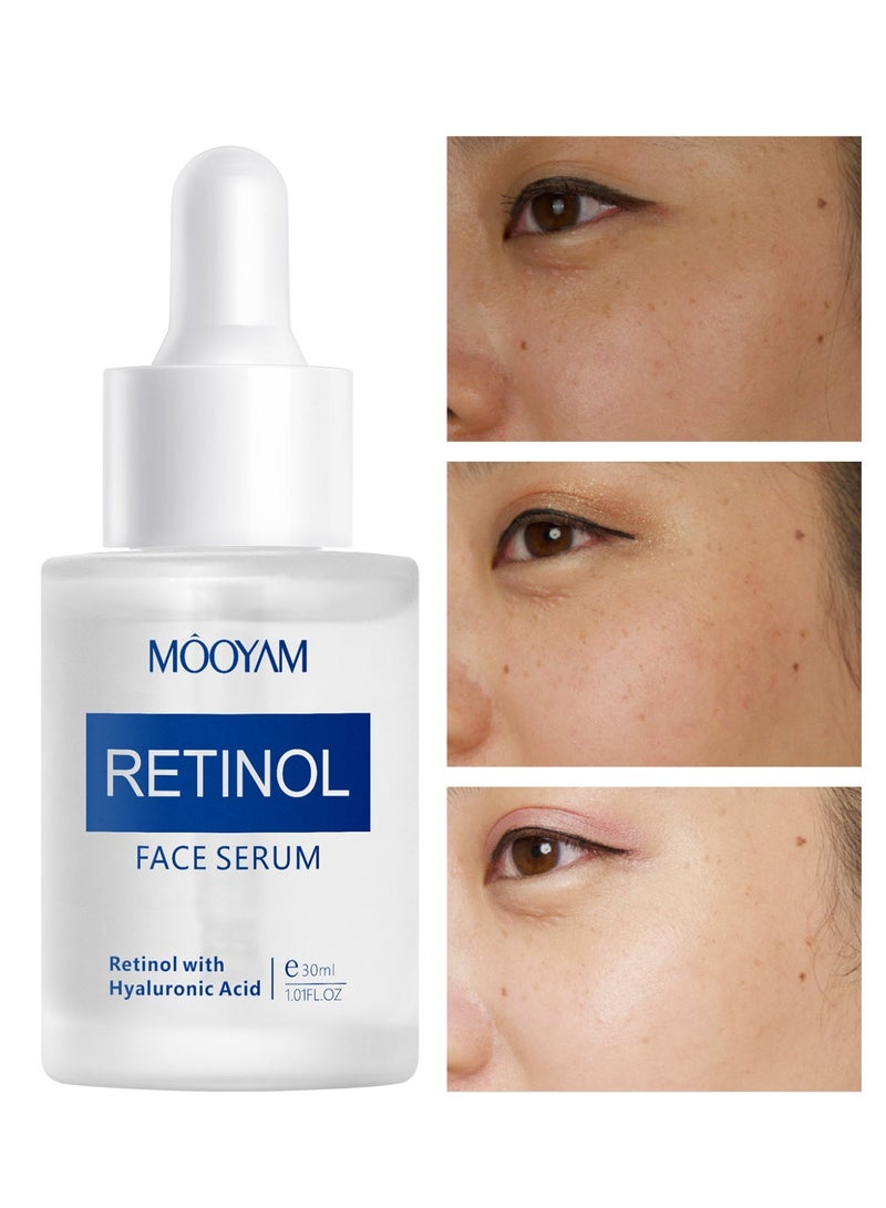 MOOYAM Retinol Face Serum with Hyaluronic Acid Anti Aging Retinol Serum for Skin Repair, Brighten Your Look, Fine Line and Wrinkles for Dull and Dry Skin 30ml - Image 1