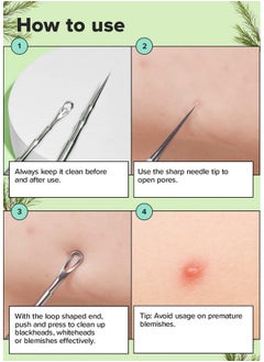 Dual-Tip Pimple Popper - Proper Popper | Blackhead Remover Tool, Pimple Popper, Comedone Extractor, 2-In-1 Stainless Steel Lancet, 1 Ea - pzsku/ZF944875A3CA8CC6E87CCZ/45/_/1734182916/42184df5-be5d-4da9-a54f-12cb1e611b28