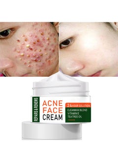 MOOYAM Acne Treatment Face Cream, Acne Spot Treatment for Face & Acne Dots, Natural Cystic Acne Treatment, For All Skin Types, Premium Acne Scar Cream & Pimple Remover - 30ML  - Image 1