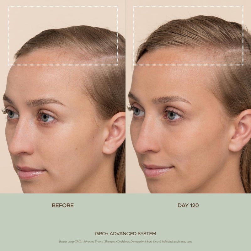 VEGAMOUR بلسم فيغامور GRO+ المتقدم للتوازن | يرطب فروة الرأس، يغذي وينعم الشعر | لعلاج علامات التساقط الشديدة | آمن للألوان، نباتي، خالي من القسوة، مصمم بدون سيليكون (8 أونصة سائلة)  - Image 2