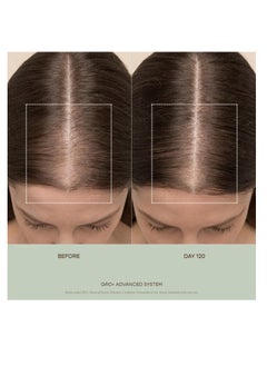 VEGAMOUR VEGAMOUR GRO+ Advanced Balancing Conditioner | Hydrates the Scalp, Nourishes and Softens Hair | For Severe Signs of Thinning | Color Safe, Vegan, Cruelty-Free, Formulated Without Silicones (8 Fl Oz)  - Image 4