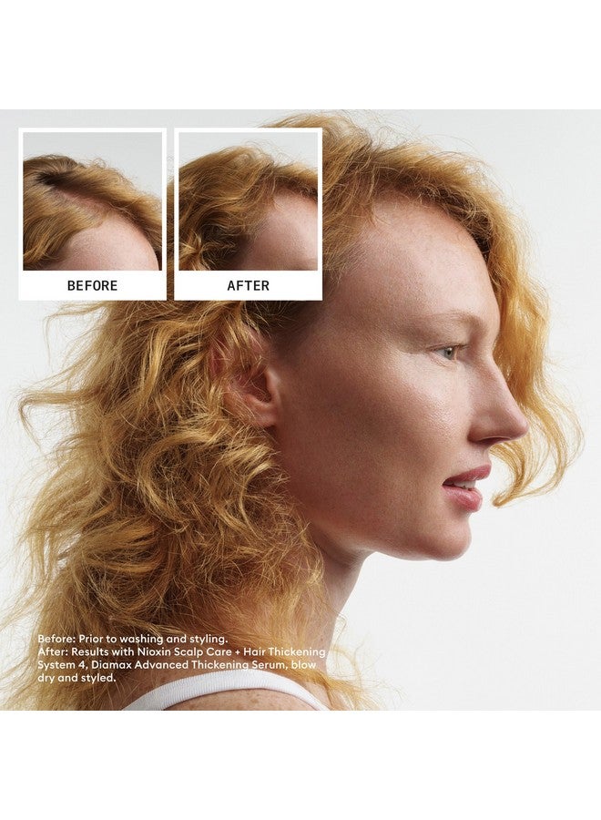 نيوكسين شامبو Nioxin System 4 لفروة الرأس والشعر - شامبو لتكثيف الشعر للشعر التالف مع تساقط الشعر المتقدم، 33.8 أونصة سائلة (قد تختلف العبوة) - Image 3