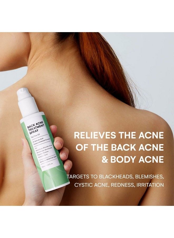 CIZ - Back Acne Treatment Back Acne Spray 2% Salicylic Acid Spray With Herbal Formula Body Acne Treatment For Teens Bacne Treatment Perfect Companion For Acne Body Wash And Salicylic Acid Body Wash - Image 1