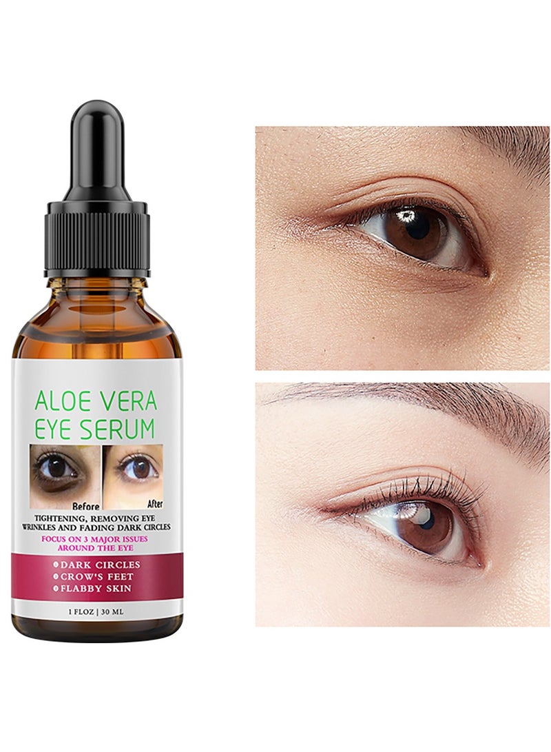 MOOYAM Aloe Vera Eye Serum 30ml for Dark Circles and Fine Lines Anti Aging Treatment Reduces Crows Feet and Wrinkles  - Image 3