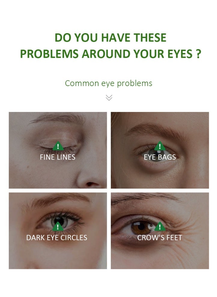 MOOYAM Aloe Vera Eye Serum 30ml for Dark Circles and Fine Lines Anti Aging Treatment Reduces Crows Feet and Wrinkles  - Image 5
