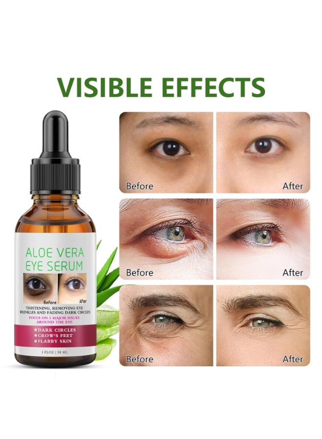 MOOYAM Aloe Vera Eye Serum 30ml for Dark Circles and Fine Lines Anti Aging Treatment Reduces Crows Feet and Wrinkles  - Image 4