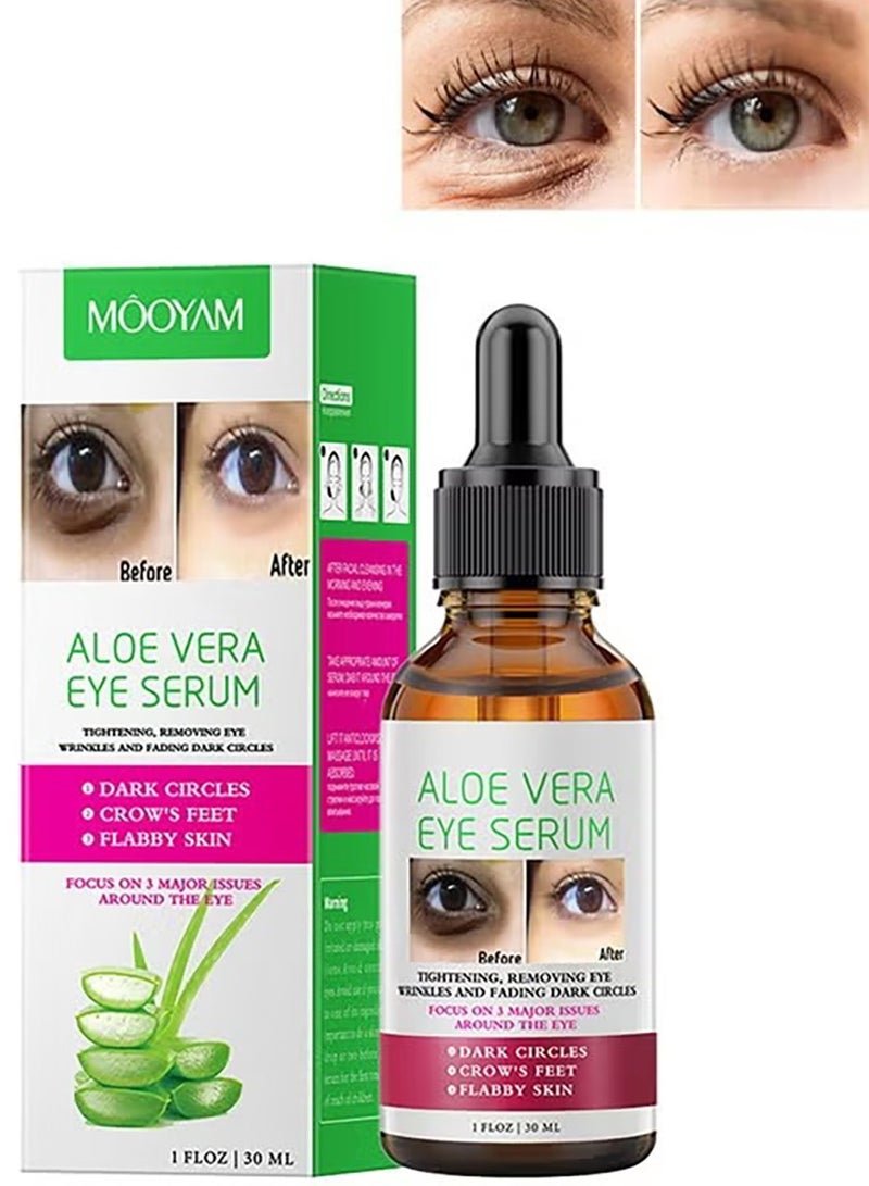 موويام مصل عين فيرا الصلوي 30 مل للدوائر المظلمة والخطوط الدقيقة لعلاج مكافحة الشيخوخة يقلل من أقدام الغربان والتجاعيد - Image 2