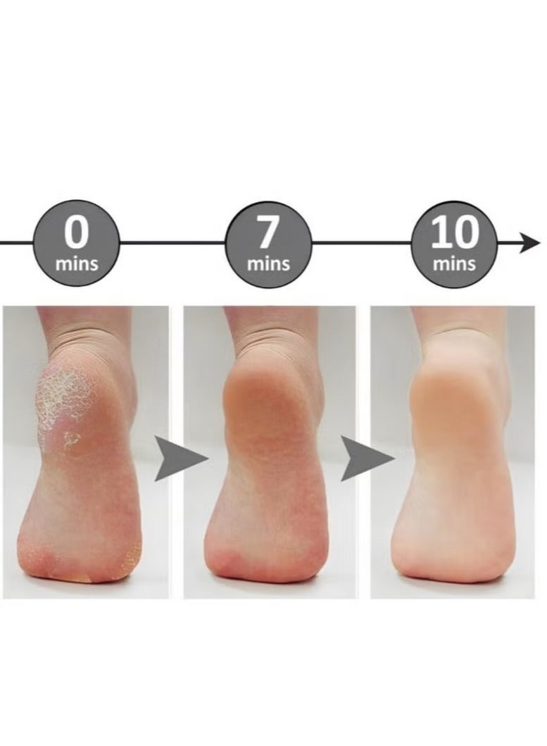 Generic Electric Foot Care File Callous Remover, Electronic Pedicure tool - Image 3