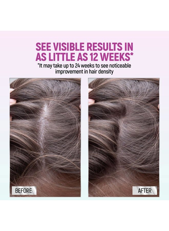 Taro Minoxidil for Women, 2.11 Oz (2 Months Supply) Clinically Proven to Regrow Hair, Topical Aerosol Foam 5%, Hair Thinning Treatment - Image 5