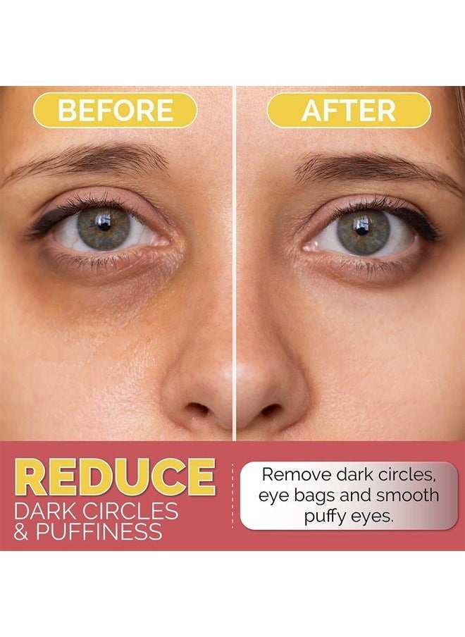 LOOKATME - Under Eye Patches for Dark Circles, Puffiness and Eye Bags with 24K Gold - Anti-Wrinkle for Puffy Eyes, Eye Masks with Hyaluronic Acid and Collagen Hydrogel Eye Gel Pads, Premium Korean Skincare 30pcs - Image 1