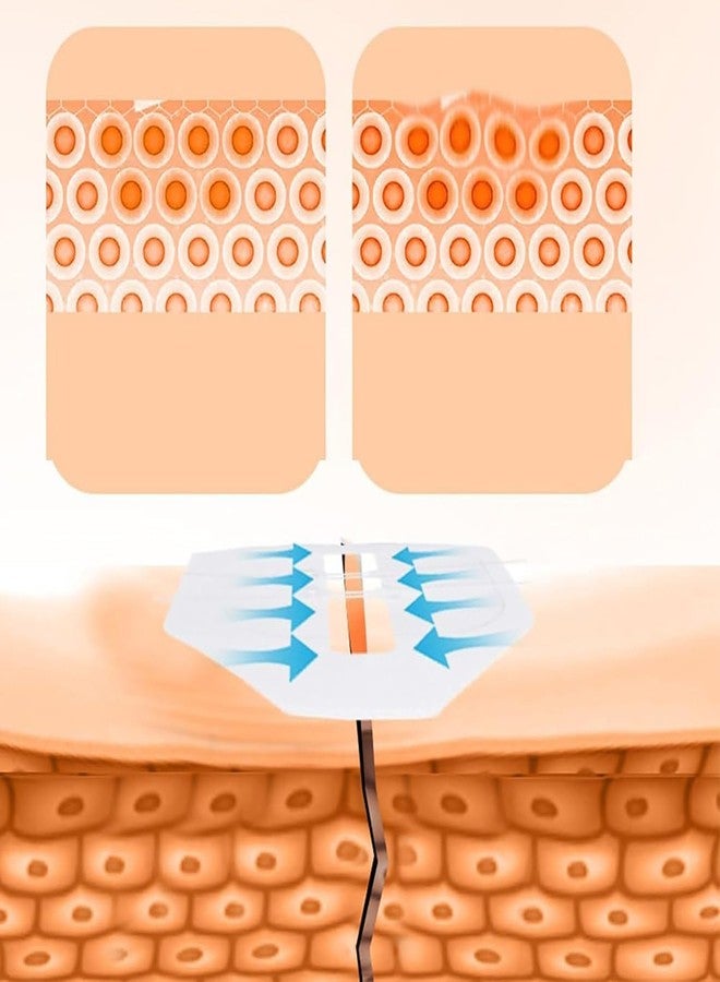 VALUEVIBES Survival Wound Closure Strips - Zip Stitch Bandage for Emergency Skin Closure | Compact First Aid Bandage for Camping, Hiking & Travel - Image 4