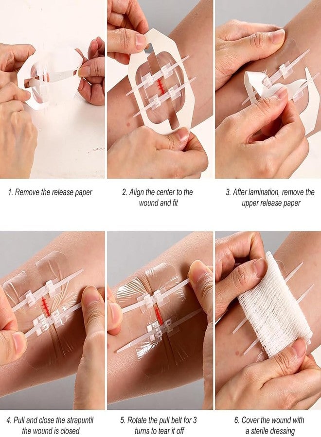 VALUEVIBES Survival Wound Closure Strips - Zip Stitch Bandage for Emergency Skin Closure | Compact First Aid Bandage for Camping, Hiking & Travel - Image 5