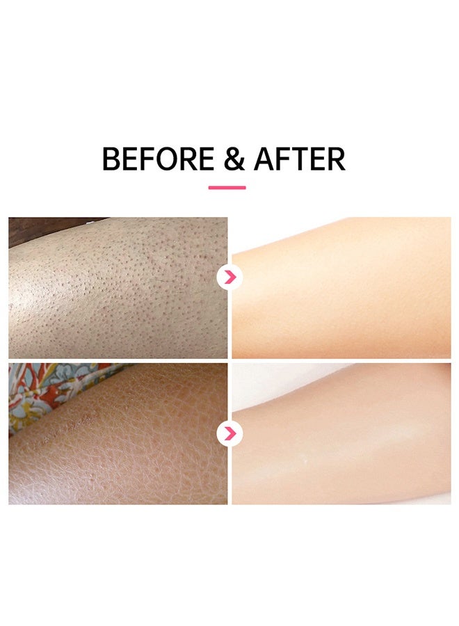 JoyPretty KP Exfoliating Repair Cream for Rough & Bumpy Skin with Urea & Vitamin C Heals Repair Dry Rough & Cracked Skin Instant Whitening Moisturization & Smoothness 50g - Image 5