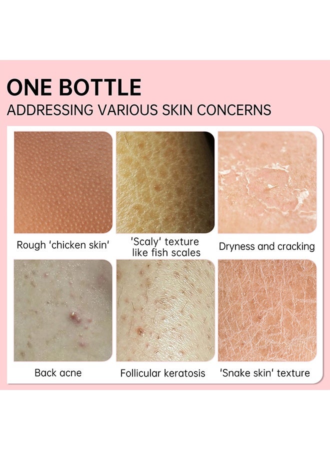 JoyPretty KP Exfoliating Repair Cream for Rough & Bumpy Skin with Urea & Vitamin C Heals Repair Dry Rough & Cracked Skin Instant Whitening Moisturization & Smoothness 50g - Image 4