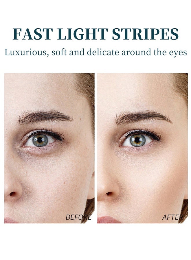 OCHEAL Eye Cream- Rapid Wrinkle Repair Eye Cream Wrinkle Smoothing Roll On Eye Massage Eyes Fade Fine Lines Reduce Dark Circles Eye Serum Tighten Eye Bags Puffiness Improve Elasticity Eye Treatment Cream 20g - Image 4