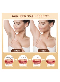 NNEWVANTE IPL Hair Removal, 3 in 1 Upgraded, Permanent Hair Removal With 999,900+ Flashe, 5 Energy Levels For Women & Men  - Image 2