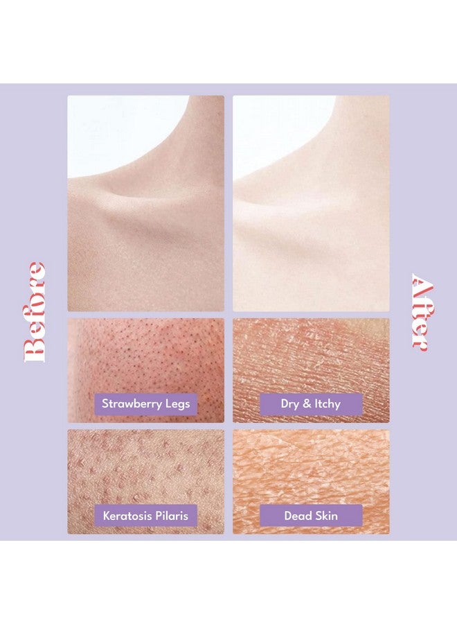 TOI:L Gentle Touch Bubble Peeling Body Pad(5Pads) Body Scrub Exfoliating Mitt For Body Exfoliating Gloves Washcloth Body Loofah 5Berry Complex Dense Bubble Bath Bath Shower Kp Bump Eraser - Image 3
