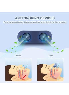 Dominy Anti Snoring Devices,Double Vortex Anti Snoring Device,Adjustable and Breathable,Up to 10 Hours,Suitable for All Nose Shapes-Blue  - Image 4