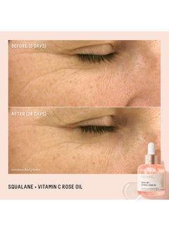 BIOSSANCE BIOSSANCE Squalane + Vitamin C Rose Oil, Advanced Facial Oil - Brightening, Firming, and Hydrating Serum for All Skin Types - Chios Crystal Oil, Damascus Rose Extract & Squalane for Radiance - 1oz  - Image 2