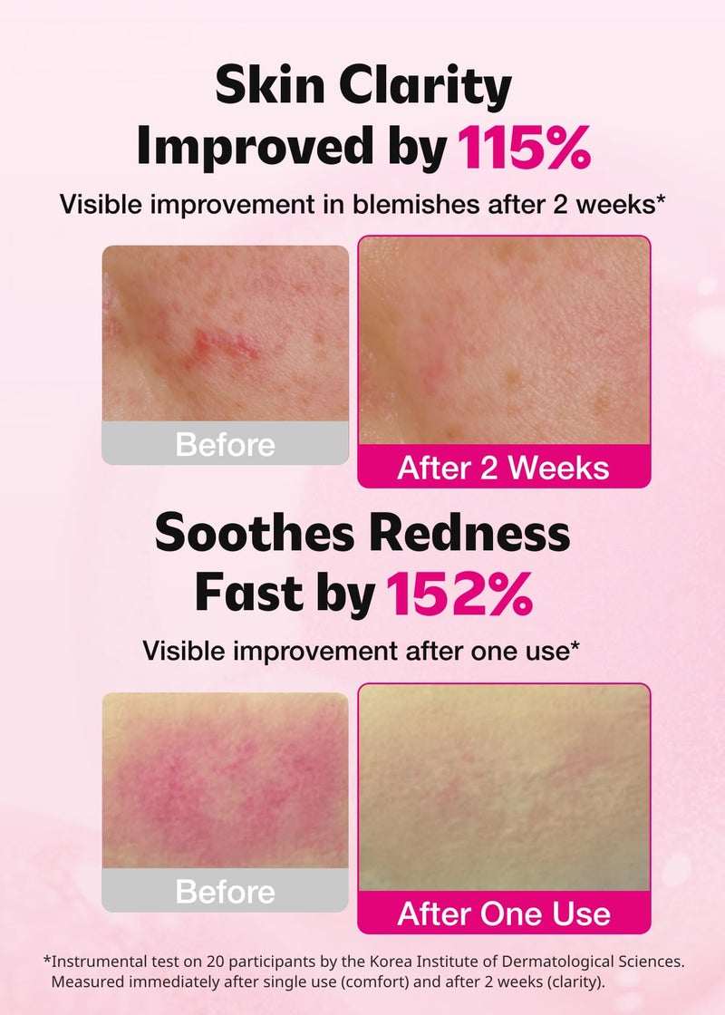 ISOI Blemish Care Up Serum for Face, Vegan Hydrating Serum for Smooth & Glass Skin Effect, Skin Barrier & Moisture Balance for Women, Arbutin & Rose Otto Oil, Korean Skin Care (1.18 fl. oz, 35ml) - Image 3