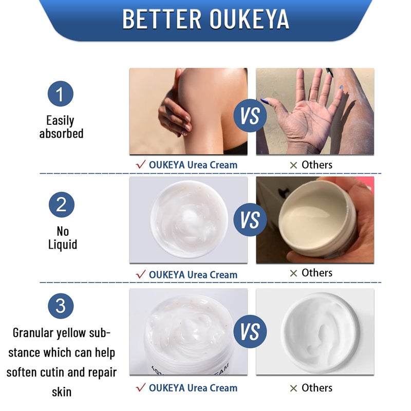 OUKEYA Urea Cream 40 Percent,Foot & Hand Cream for Dry Cracked,Urea Lotion for Feet Maximum Strength(4 Packs) - Image 3