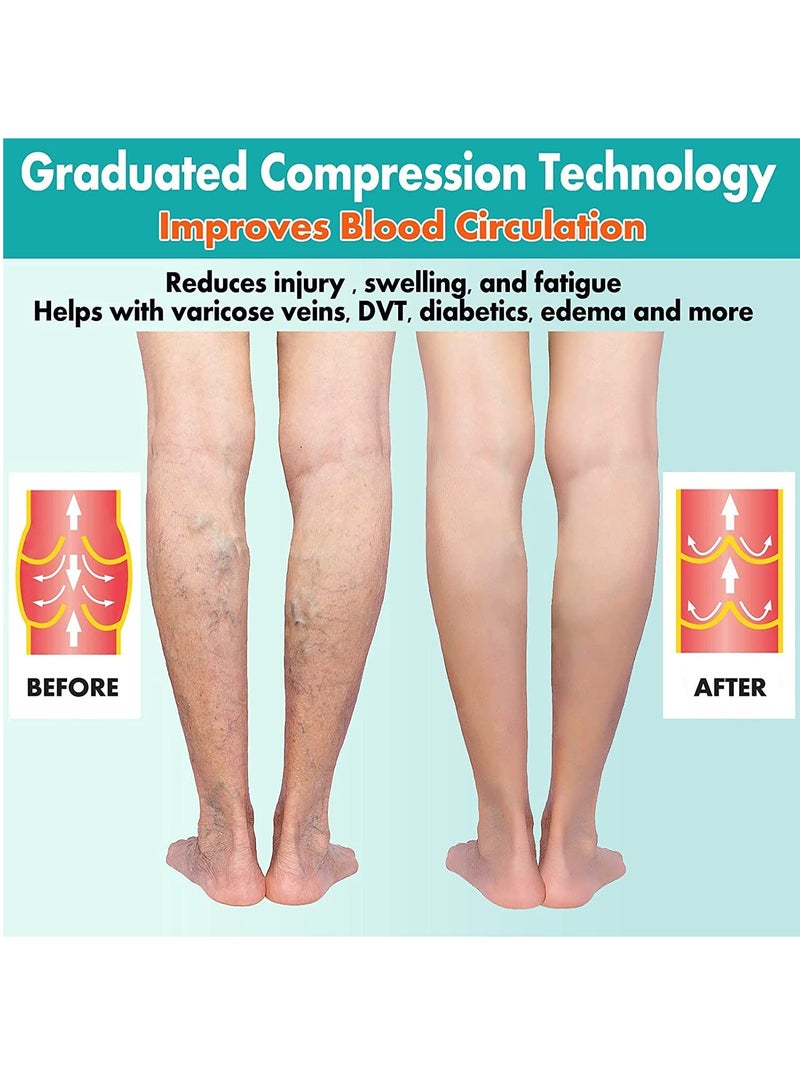 2 Pairs Compression Socks Open Toe Compression Stockings Knee High Socks with Zipper Compression Pantyhose 15-20mmHg for Improves Blood Circulation Prevents Leg Swelling (Black) - Image 3