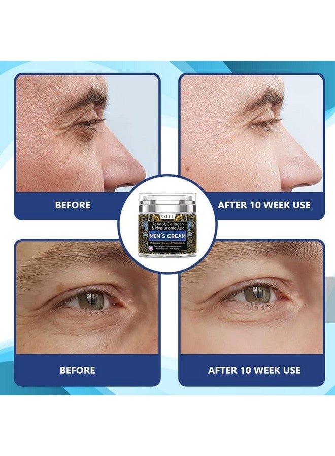 ڤايت مرطب بشرة الوجه للرجال بالكولاجين والريتينول المضاد للشيخوخة ومضاد للتجاعيد تحت العينين، كريم العناية بالوجه للرجال بالكركديه والعسل وحمض الهيالورونيك وفيتامين سي، صنع في الولايات المتحدة الأمريكية - Image 4