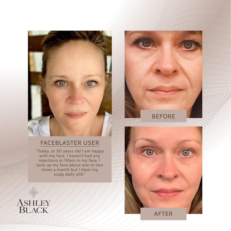 FasciaBlaster The FaceBlaster by Ashley Black A Collagen Boosting Fascia Remodeling Skin Tightening Face Contouring and Massaging Tool - Image 5
