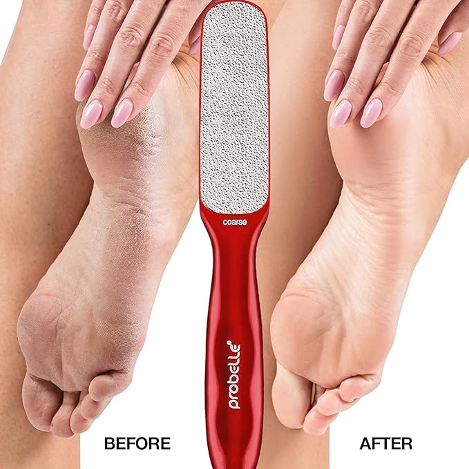 Probelle Double Sided Multidirectional Nickel Foot File Callus Remover Immediately Reduces calluses and Corns to Powder for Instant Results Safe Tool Dark Grey - Image 4