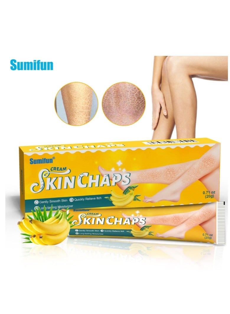 سوميفون مقياس جلد الثعبان كريم تشققات الجلد كريم يخفف الكيراتين لطيف ناعم تبييض البشرة وترطيبها يخفف الحكة المراهم العشبية 20 جرام - Image 1