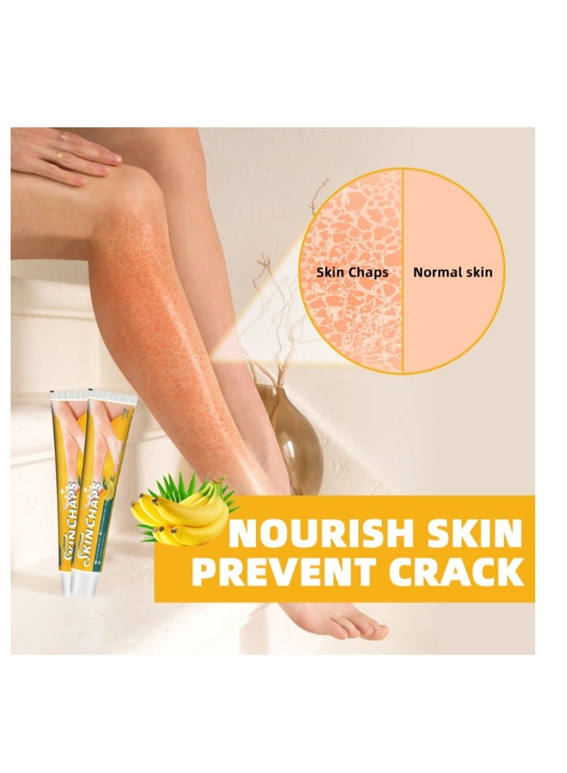 سوميفون مقياس جلد الثعبان كريم تشققات الجلد كريم يخفف الكيراتين لطيف ناعم تبييض البشرة وترطيبها يخفف الحكة المراهم العشبية 20 جرام - Image 2