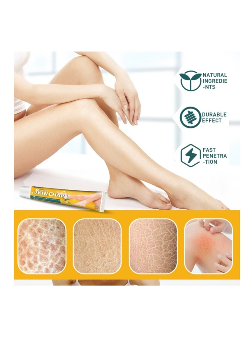 سوميفون مقياس جلد الثعبان كريم تشققات الجلد كريم يخفف الكيراتين لطيف ناعم تبييض البشرة وترطيبها يخفف الحكة المراهم العشبية 20 جرام - Image 3