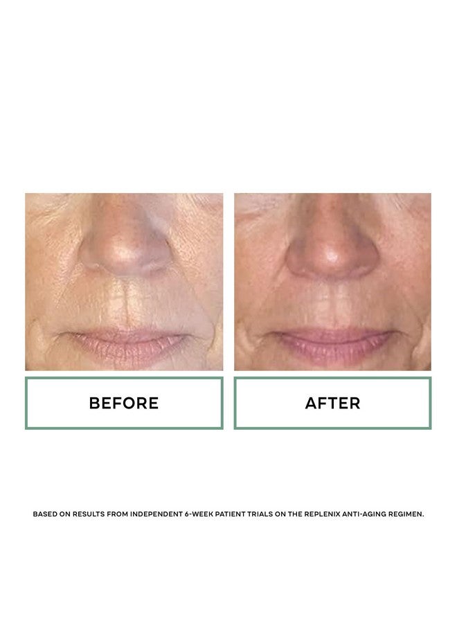 Replenix Antioxidant Hydrating Cleanser, Medical-Grade Gentle Face Wash for Dry & Mature Skin (1.7 fl oz) - Image 4