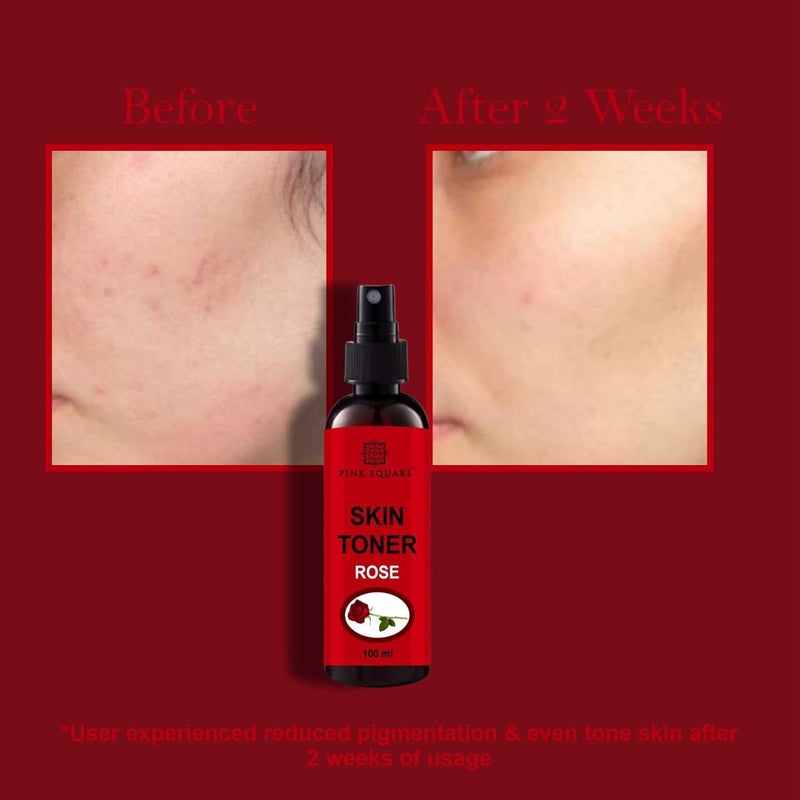 Pink Square Rose Petal Toner 100ML  Vitamin C Face Toner 100ML Rejuvenate The Skin  Restores pH Balance  Deep Cleanses Pores  Prevents Skin Infections Pack of 2 - Image 2