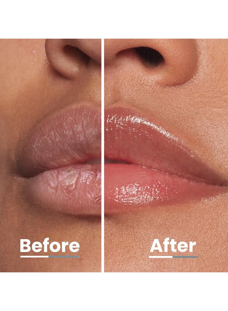 HYPHEN Vitamin Infused Peptide Lip Balm - Vanilla for Dry & Chapped Lips | Hydrating & Moisturizing Lip Balm for Men & Women | Lip Balm for Dark Lips | Smoothen Lips & Repair Moisture Barrier | Hyphen | Hyphen Products | Vegan, SLS & Parabens Free | 10 gm - Image 4