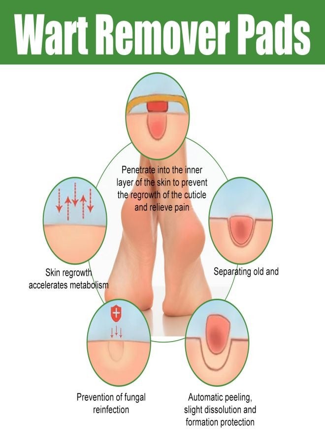 EELHOE   Wart Removal Treatment Relief Corn Pain and Foot Care Maximum Strength One Step Plantar Wart Remover Foot Pads, 30Count - Image 5