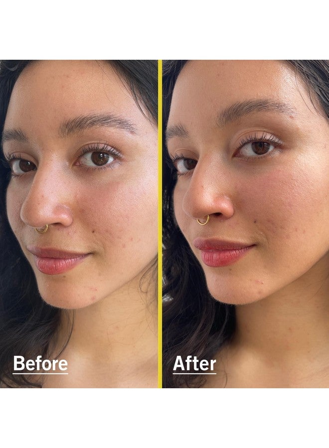 First Aid Beauty واقي شمس سائل معدني خفيف الوزن من إيرست إيد بيوتي مع أكسيد الزنك SPF 30 خفيف بشكل فاخر للاستخدام اليومي 1.5 أونصة - Image 4