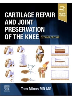 Cartilage Repair and Joint Preservation of the Knee  - Image 1