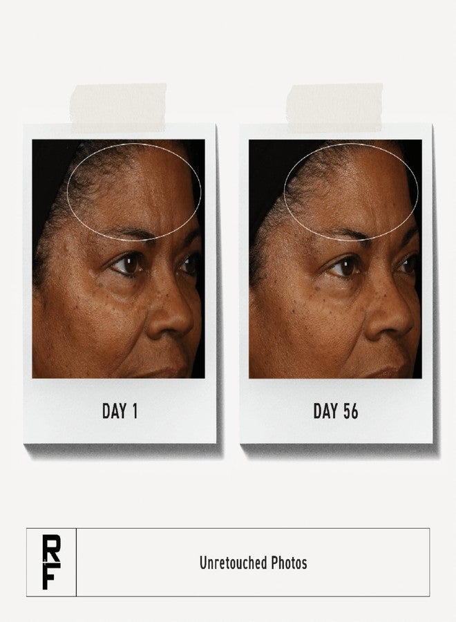 Rodan Fields RODAN + FIELDS Redefine Overnight Restorative Cream | Step 3 PM | Anti Aging Face Moisturizer for Deep Wrinkles & Fine Lines | Firms & Tightens Skin | Night Face Cream | Glycolic Acid & Bakuchiol - Image 3