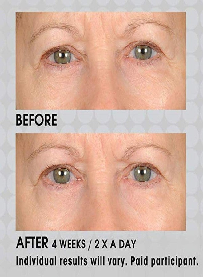 nassif md NassifMD Under Eye Smoother Firming Eye Cream, Anti Aging Eye Cream for Women, Under Eye Cream Dark Circles and Puffiness, Eye Serum Anti Aging Wrinkles - Image 5